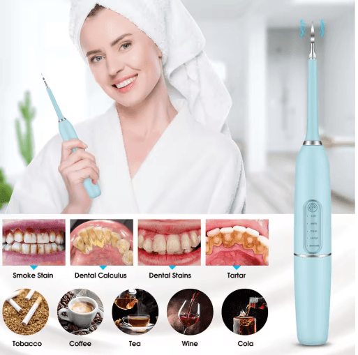 Electric Dental Calculus Remover – Teeth Cleaning & Whitening Scaler Device