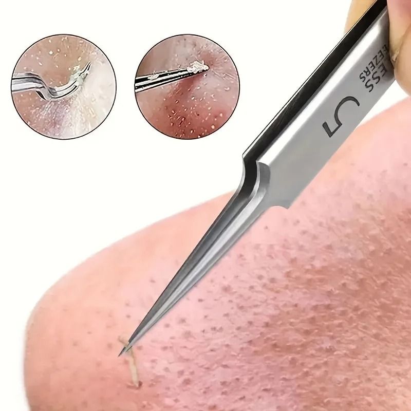 Stainless Steel Tweezers for Powerful Blackhead Removal – Professional Skincare Tool