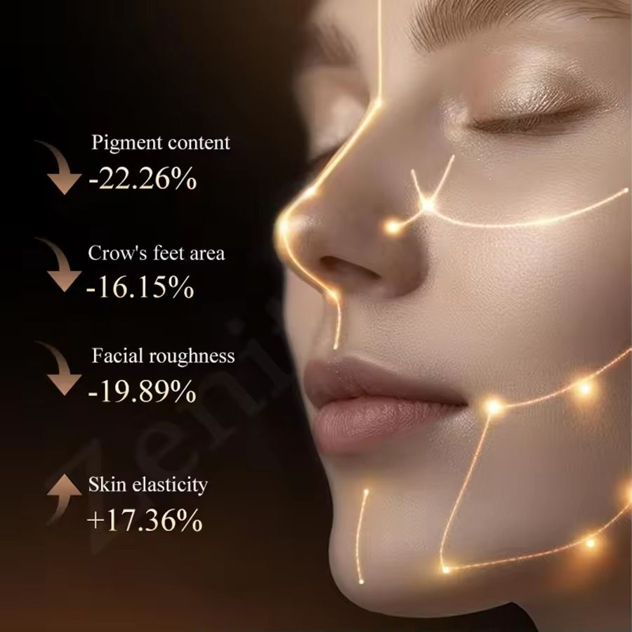 DPL Milk Light Skin Rejuvenation Device with Spot Removal and Anti-Wrinkle Therapy