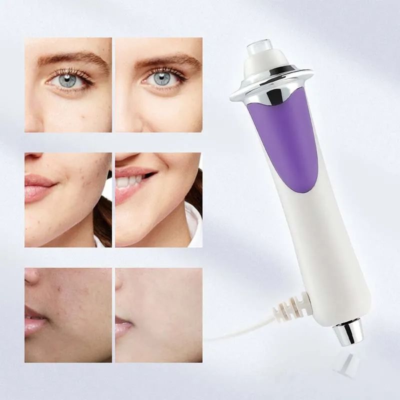 RF EMS Microcurrent Skin Tightening Anti Wrinkle Face Lifting Device, Radio Frequency Beauty Oxygen Pen