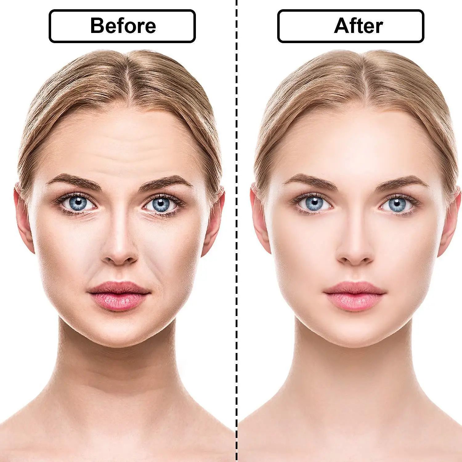Reusable Silicone Anti Wrinkle Face and Neck Patches Set