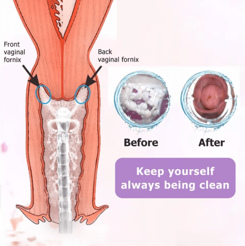 Reusable Vaginal & Anal Cleansing Syringe – 300/600ML Personal Hygiene Flushing Kit