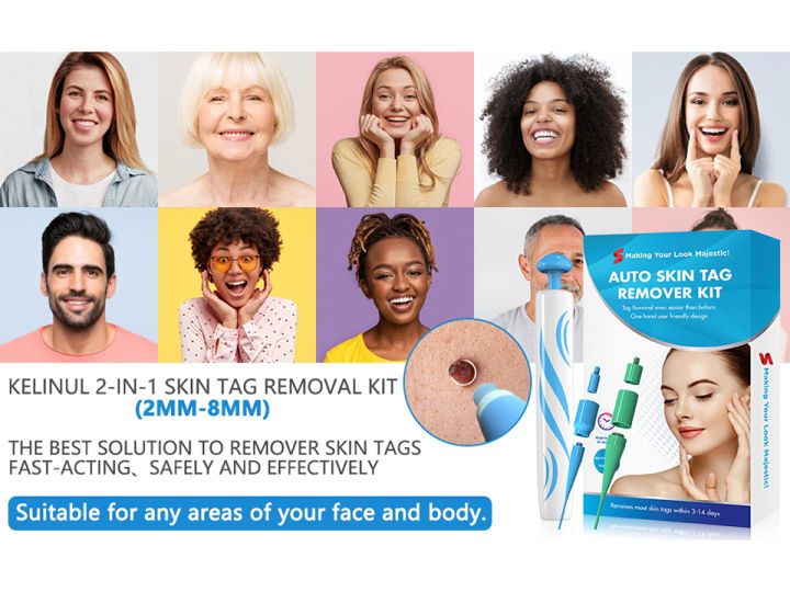 2-in-1 Skin Tag and Mole Remover Kit – Safe, Painless At-Home Wart Removal Device