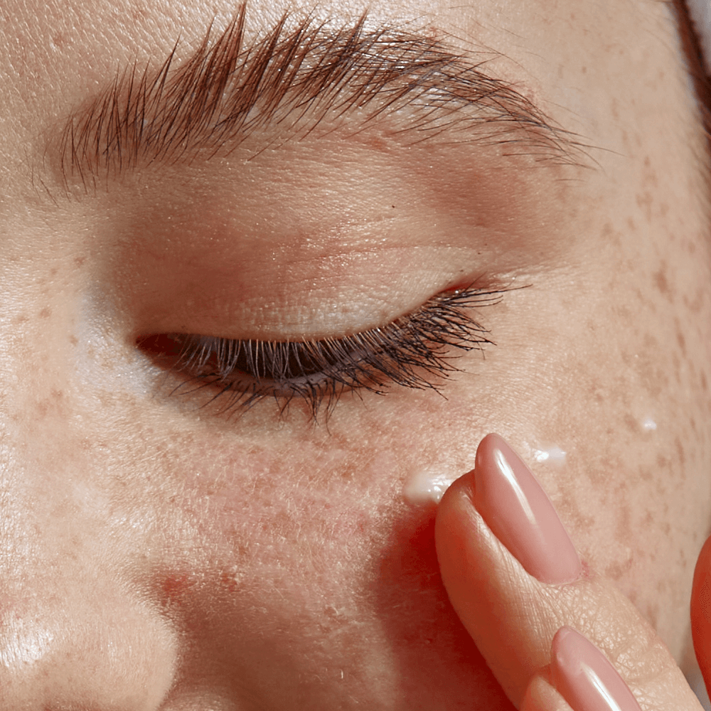 Eye Milia Removal Cream – Ideal Skincare Gift
