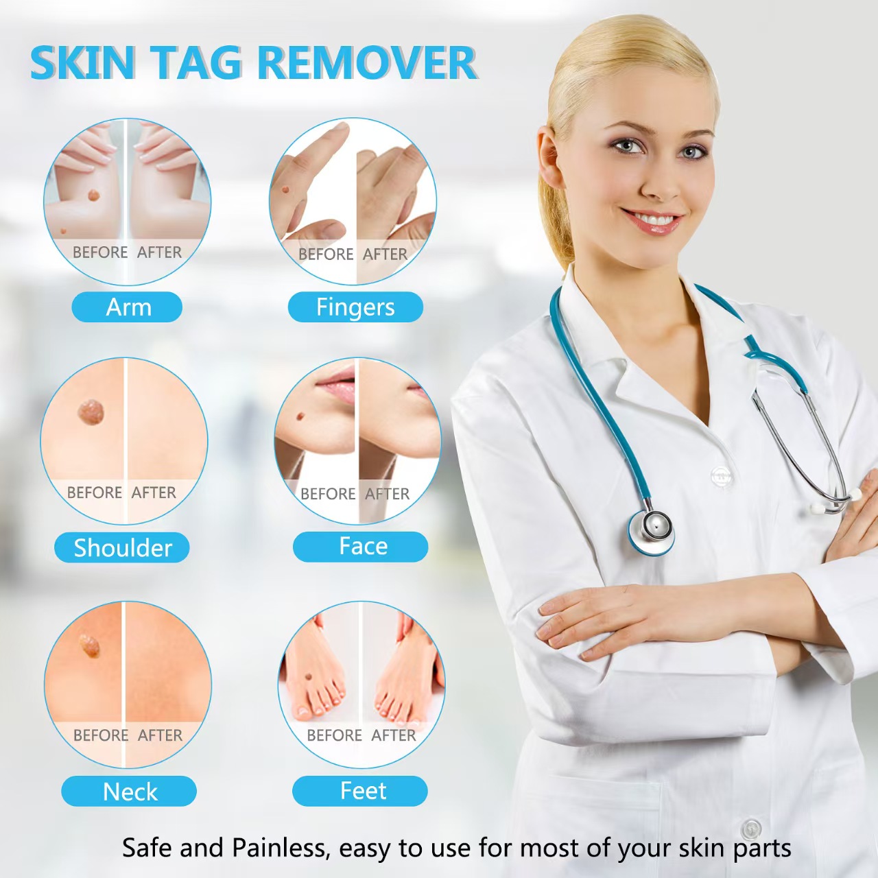 3-in-1 Skin Tag Remover Pen Painless Mole and Wart Removal Tool for At-Home Skin Care