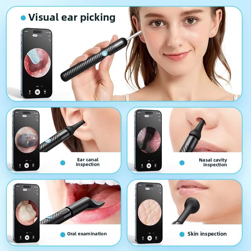 Wireless Ear Cleaner with 8MP Camera – Rechargeable Ear Wax Removal Kit with Ear Spoon