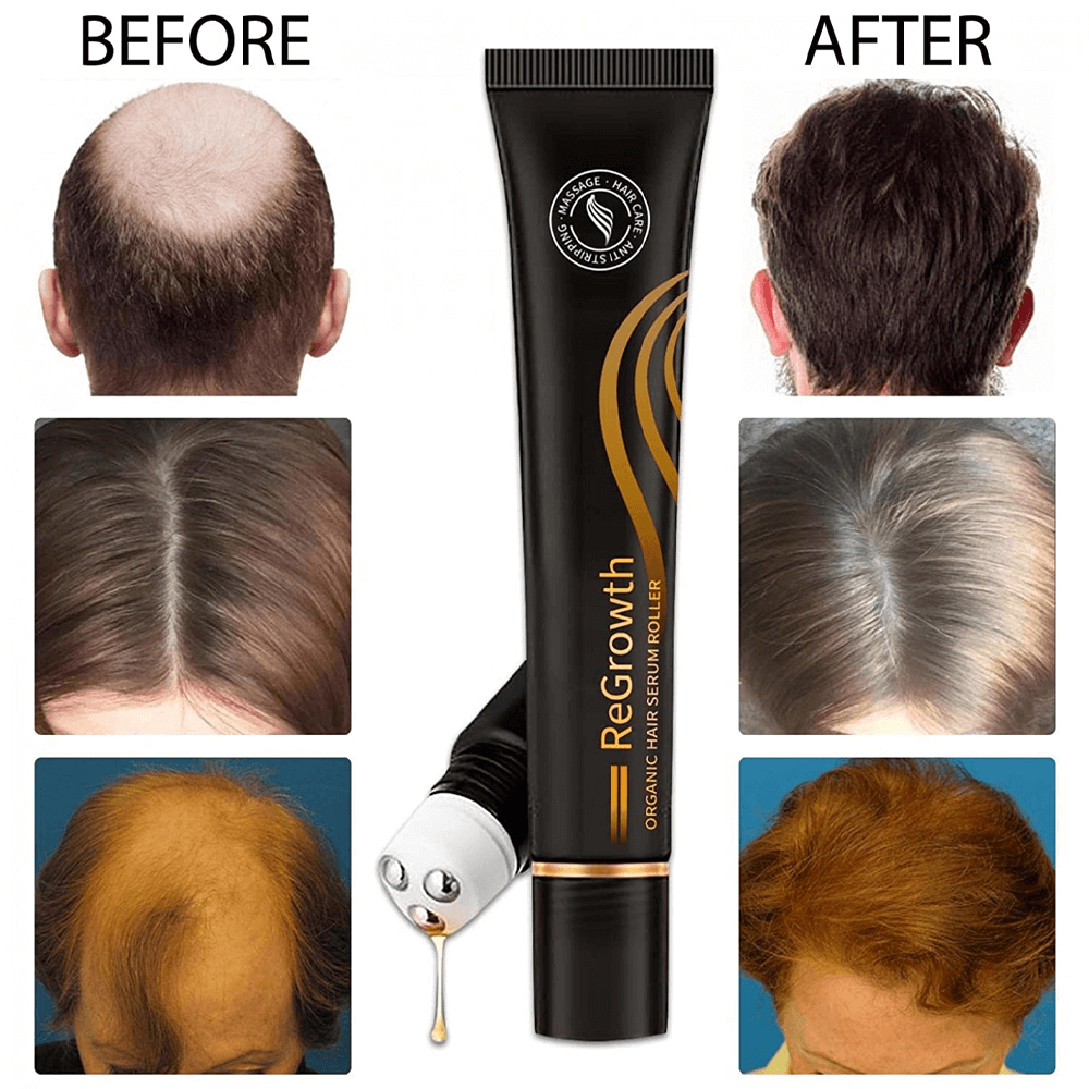 Triple Roll-On Massager Hair Growth Essence