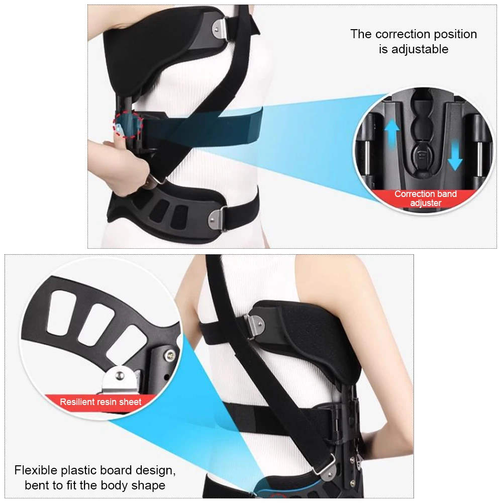 Adjustable Scoliosis Posture Brace for Spinal Alignment Support and Daily Comfort