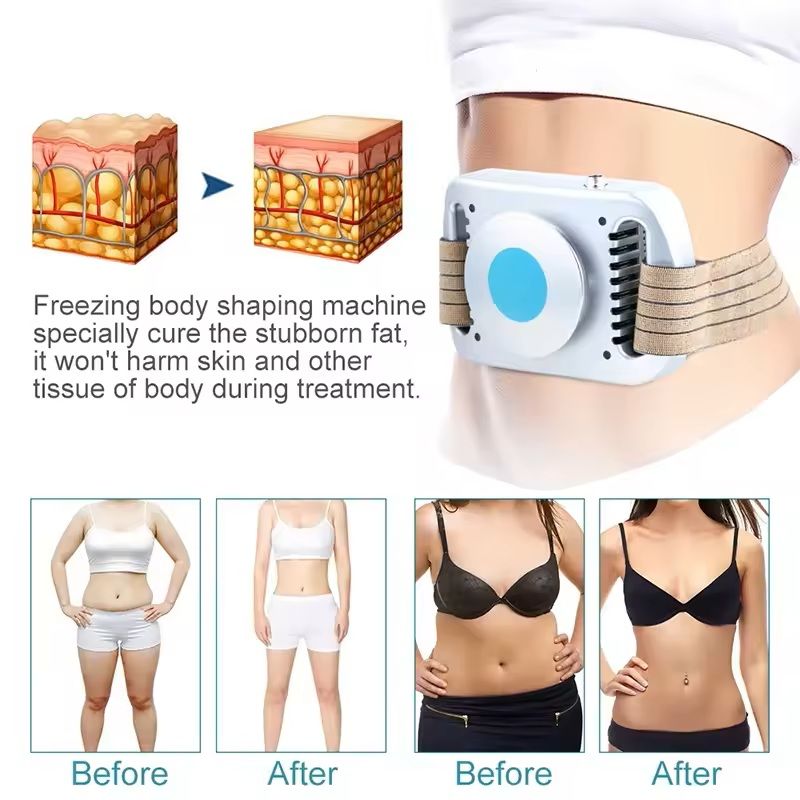 Cryolipolysis Fat Freezing Machine Body Slimming Device for Belly Fat