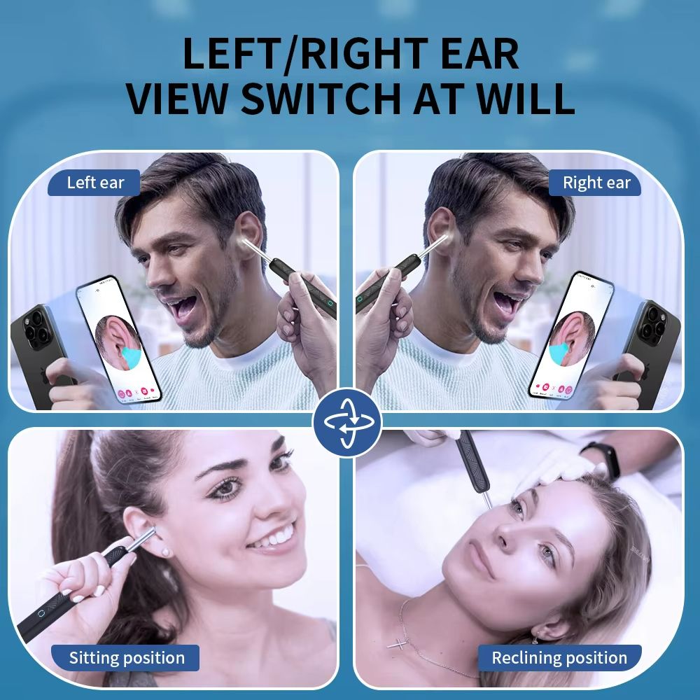 Wireless Ear Cleaner with Camera – USB-C Rechargeable Otoscope Earwax Removal Tool