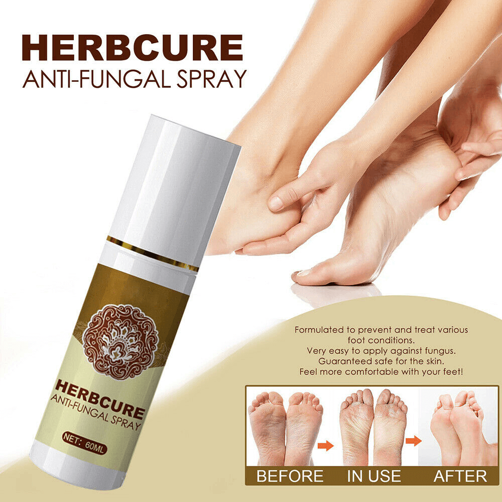 Anti-Fungal Treatment Spray
