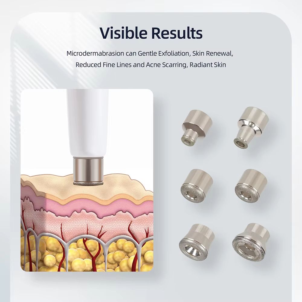 Professional Diamond Microdermabrasion Machine – Home Facial Exfoliation & Deep Cleaning Skin Care Device