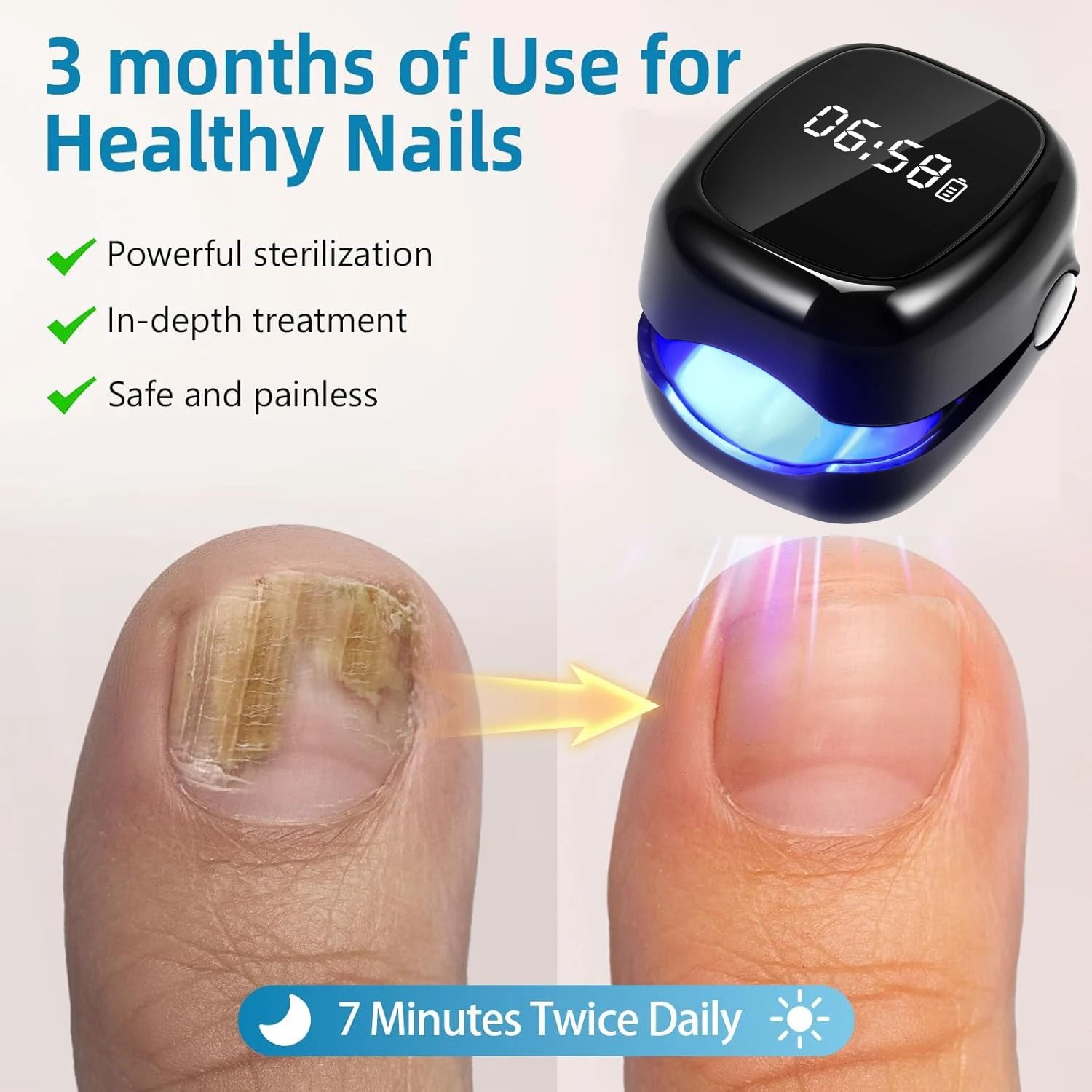 Nail Care Laser Device for Improving Nail Appearance and Smoothness