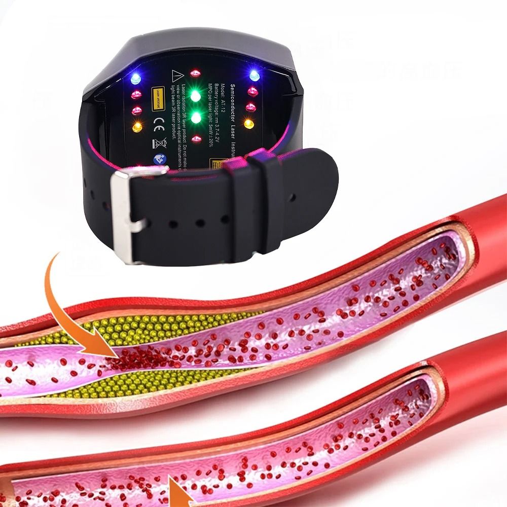 Laser Therapy Watch for Circulation and Vascular Wellness