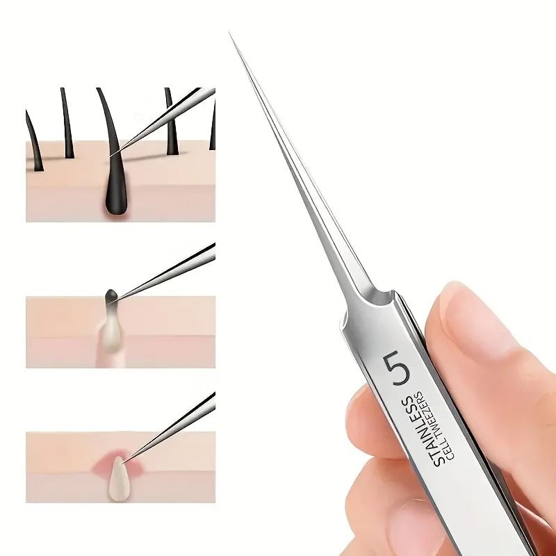 Stainless Steel Tweezers for Powerful Blackhead Removal – Professional Skincare Tool
