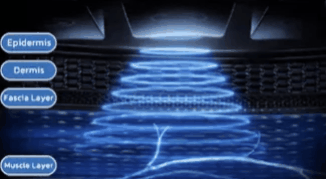 CPT2404051446-326x179.gif