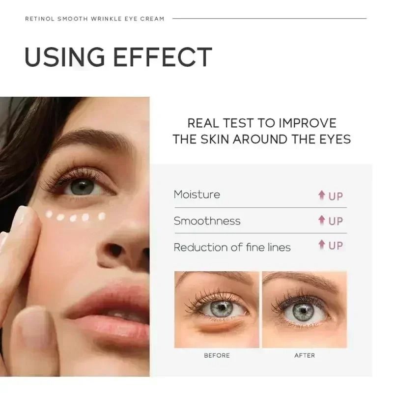 Instant Eye Bag Removal Cream – Collagen Infused Anti-Wrinkle & Firming Therapy