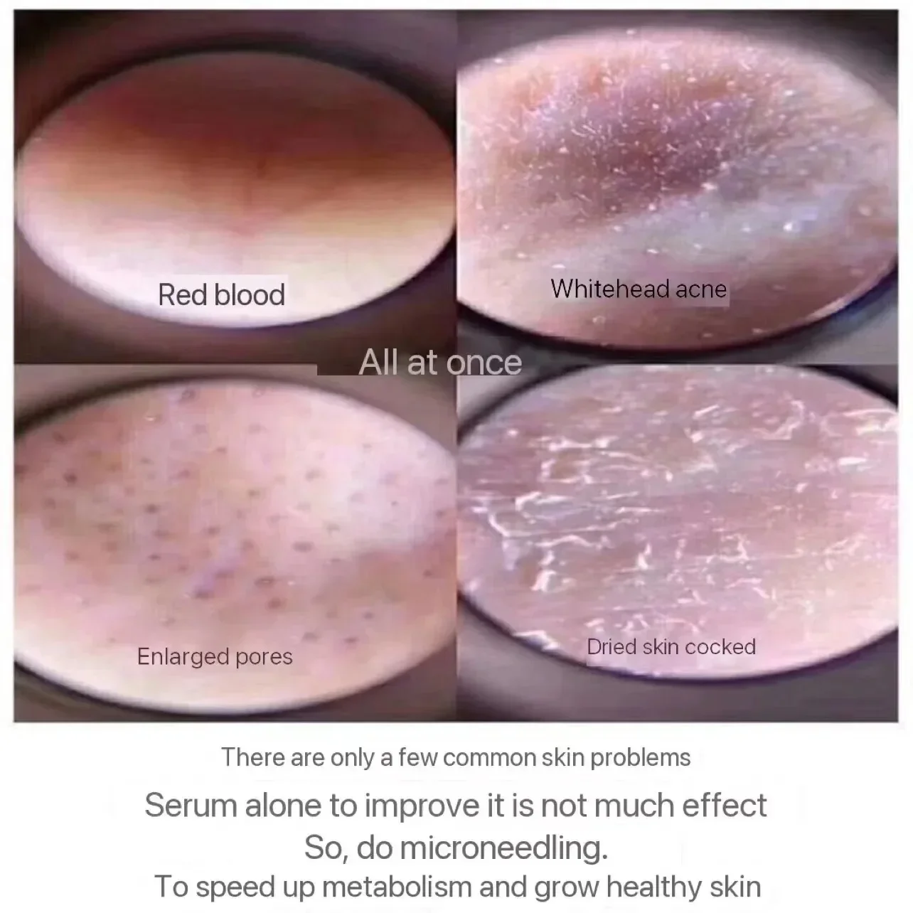 Sponge Microcrystal Spicules Freeze-Dried Powder Collagen Booster, Natural Skin Cell Renewal Treatment Deep Dermis