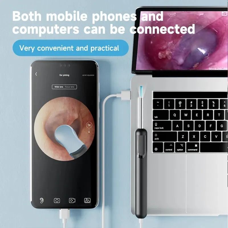 Smart Ear Wax Removal Camera Tool