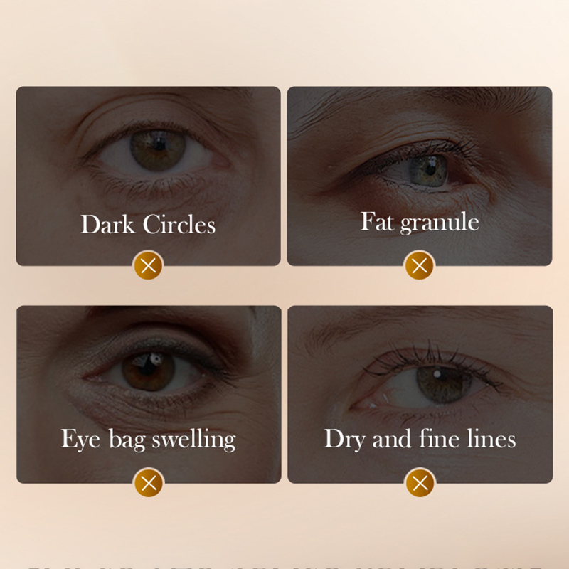 Anti Aging Snake Venom Peptide Caffeine Eye Cream Anti Wrinkle Dark Circles Care