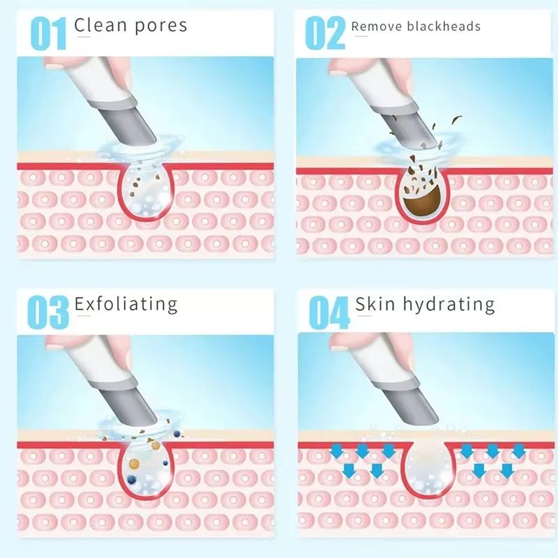Hydra Dermabrasion Facial Device – Blackhead Remover & Oxygen Bubble Skin Cleaner