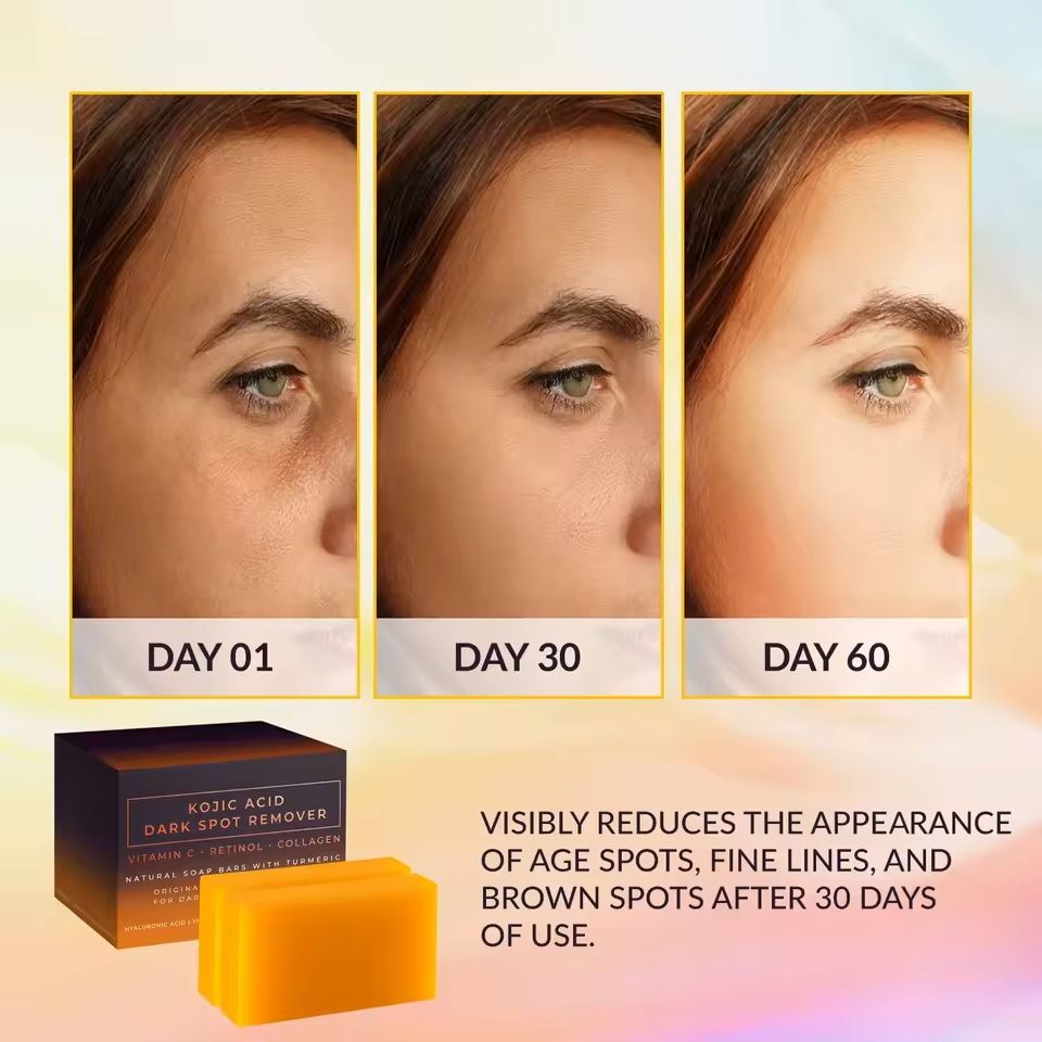 Kojic Acid Brightening Soap Bar