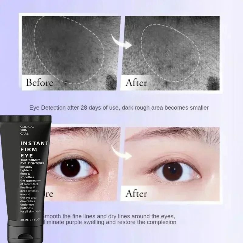 Instant Eye Bag Removal Cream – Collagen Infused Anti-Wrinkle & Firming Therapy