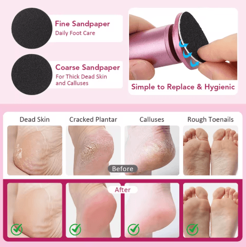 SmoothStep Pro Electric Foot Callus Remover Pedicure Tool Set