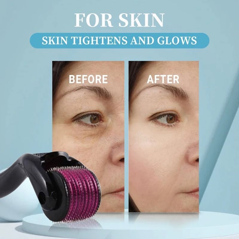 Professional 540 Titanium Derma Roller - Hair & Beard Regrowth Treatment