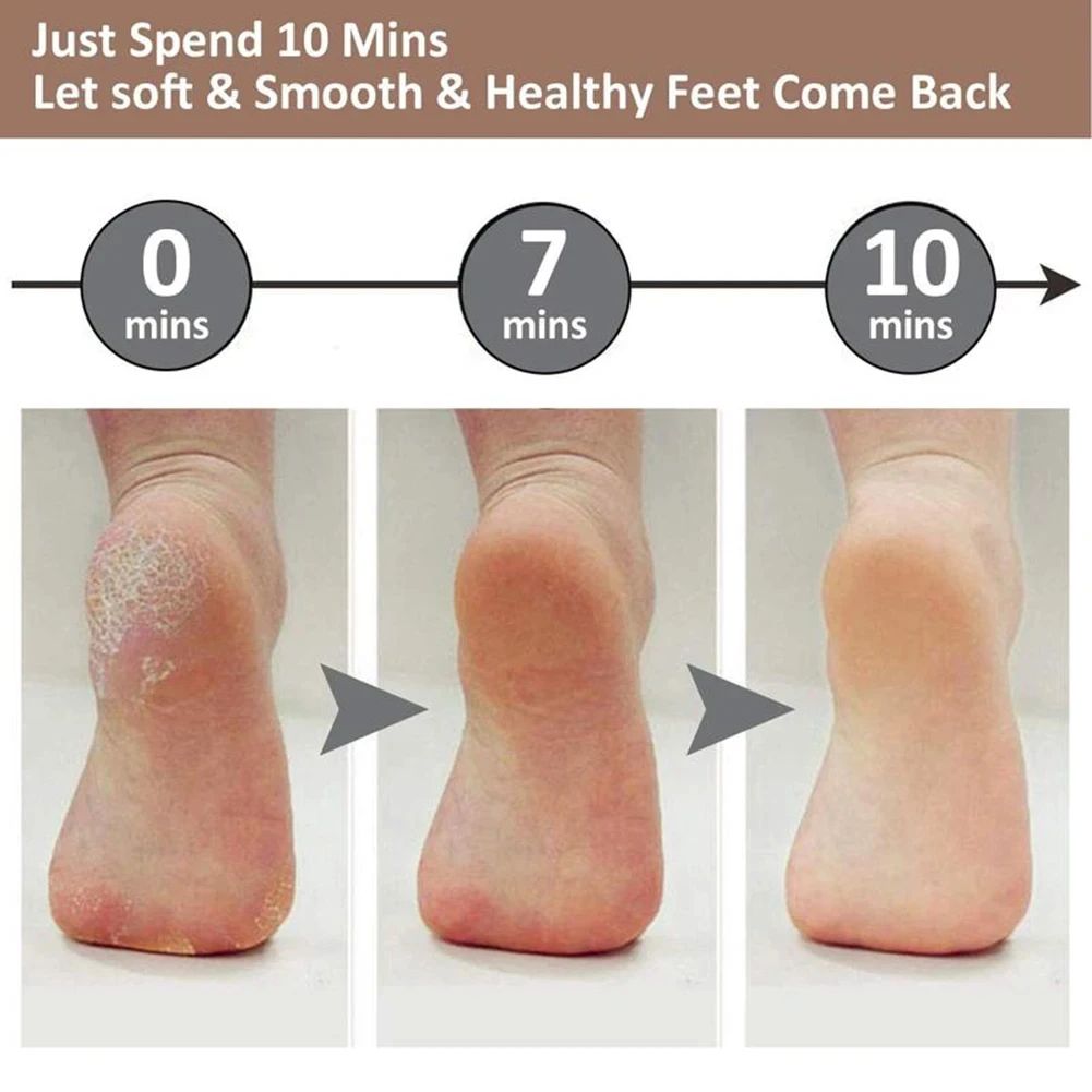 SilkStep Rechargeable Electric Callus Remover for Smooth Feet