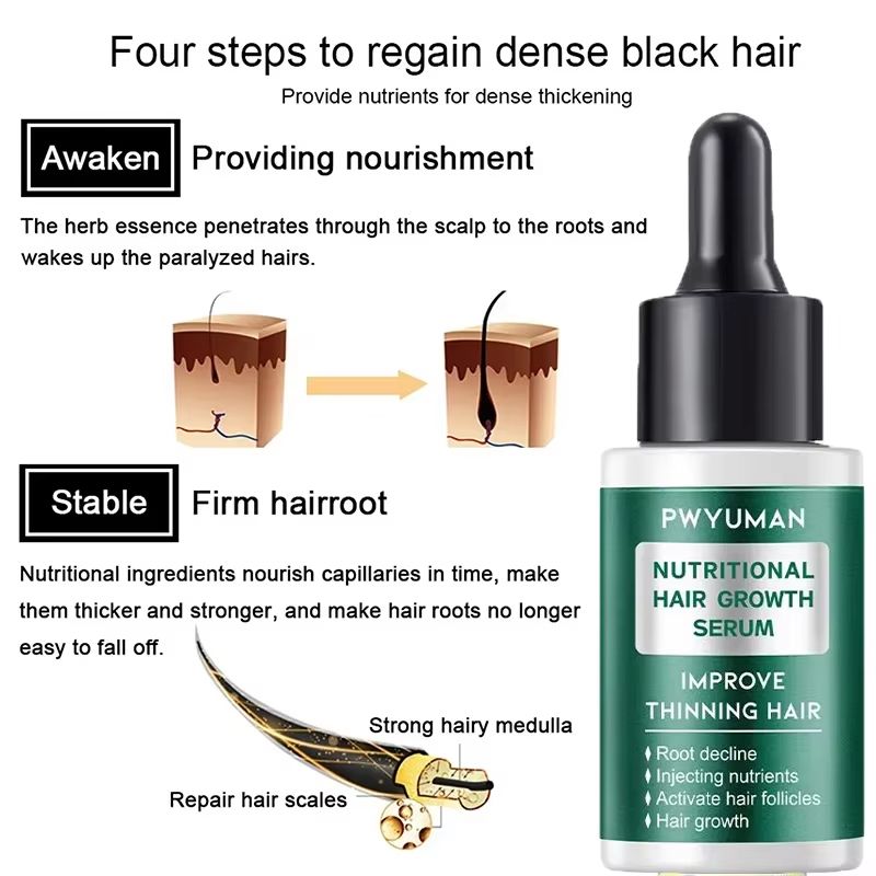 Ginger Germinal Hair Growth Serum - Intensive 7-day Root Nourish and Hair Repair Elixir