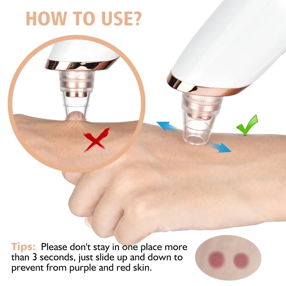 Electric Blackhead Remover Vacuum Deep Pore Facial Cleansing Skin Care Tool