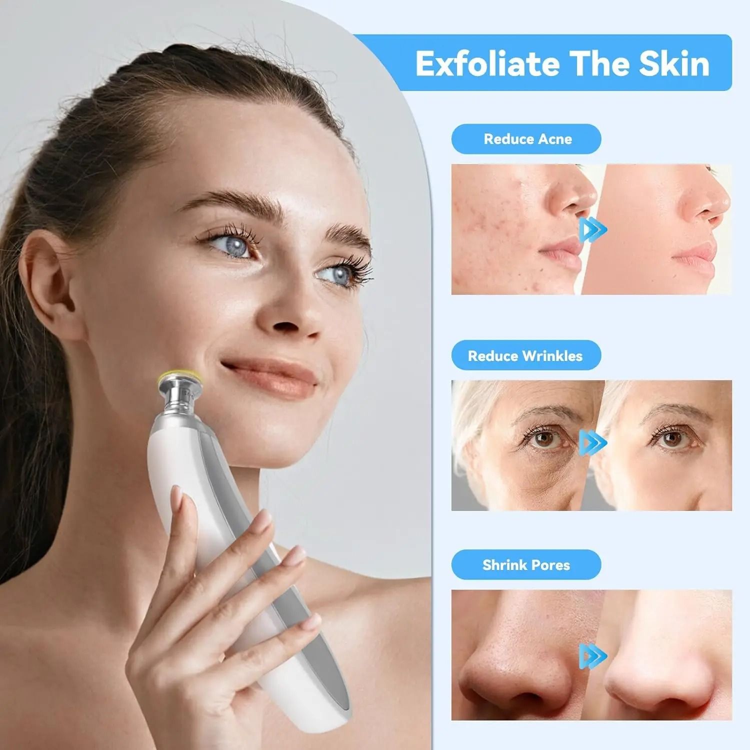 Upgraded Diamond Microdermabrasion Machine Professional Blackhead Removal and Facial Skin Care Device