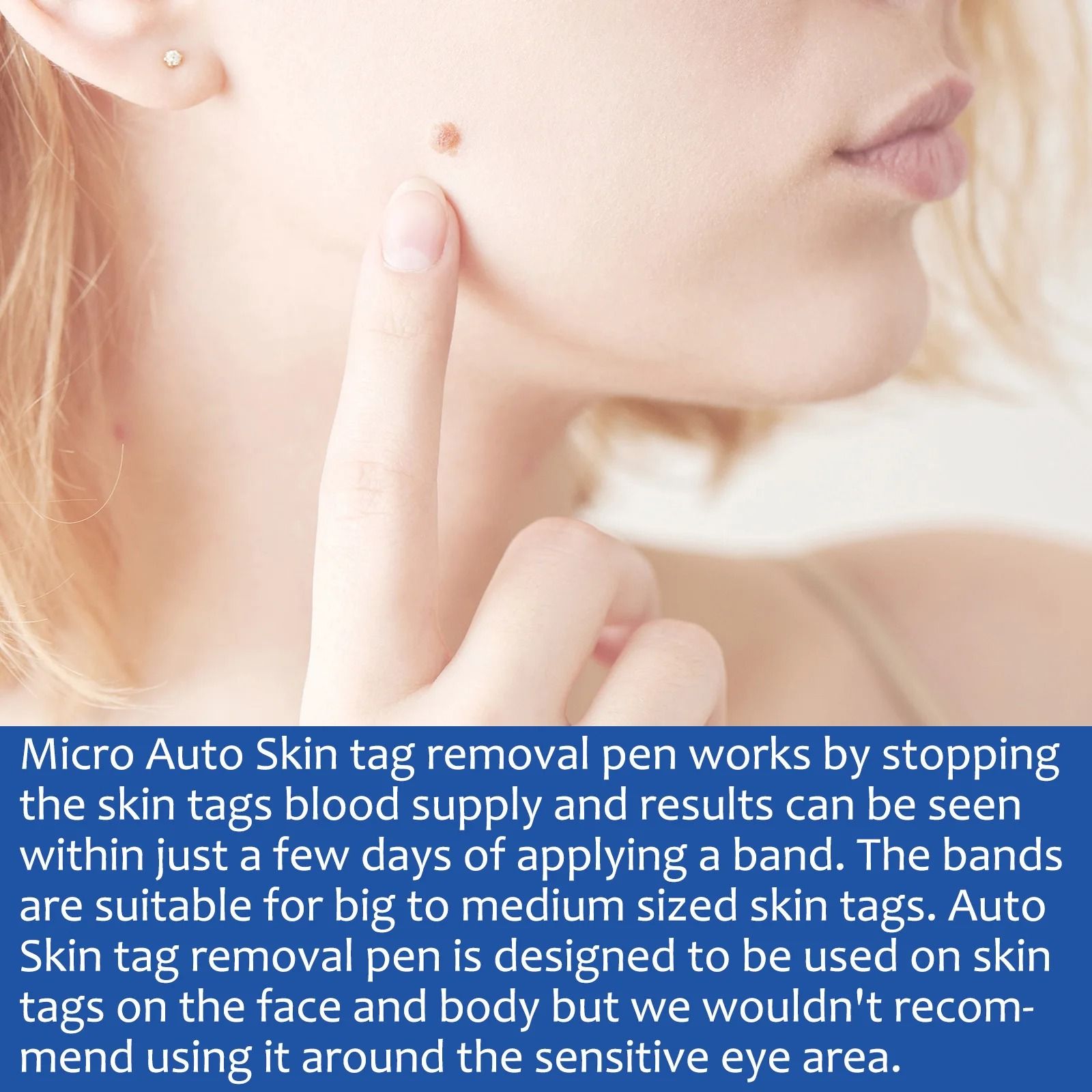 2 in 1 Painless Skin Tag and Mole Removal Kit for Clearer Skin