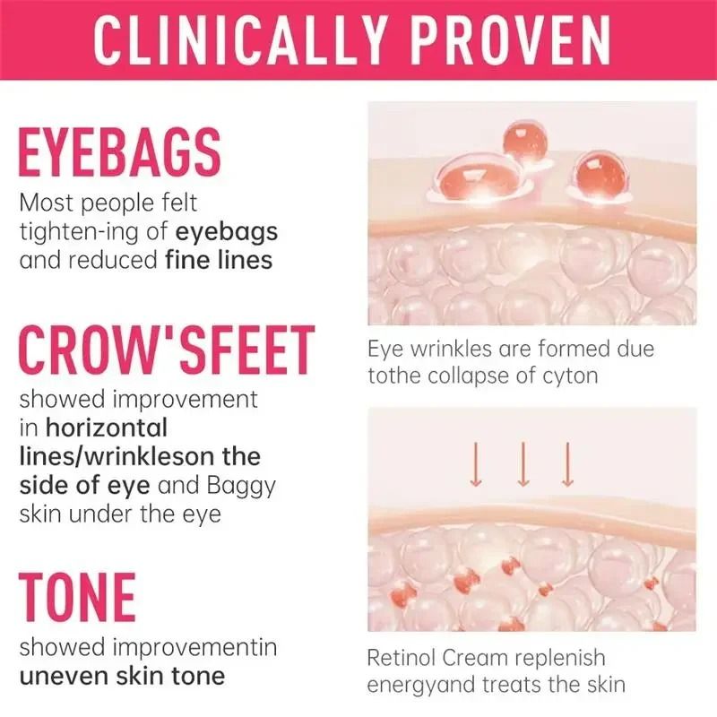 Instant Eye Bag Recovery Cream – Retinol Infused Anti-Wrinkle & Firming Therapy