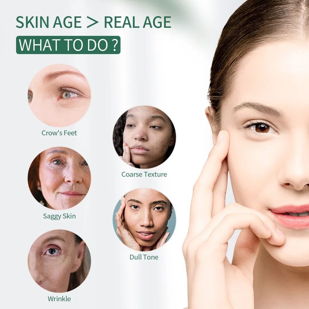 448KHz High Frequency RF Skin Tightening and Facial Lifting Device