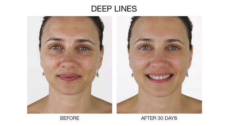 Stem cell serum anti aging real stem cell cultures matrixyl 3000 hyaluronic acid