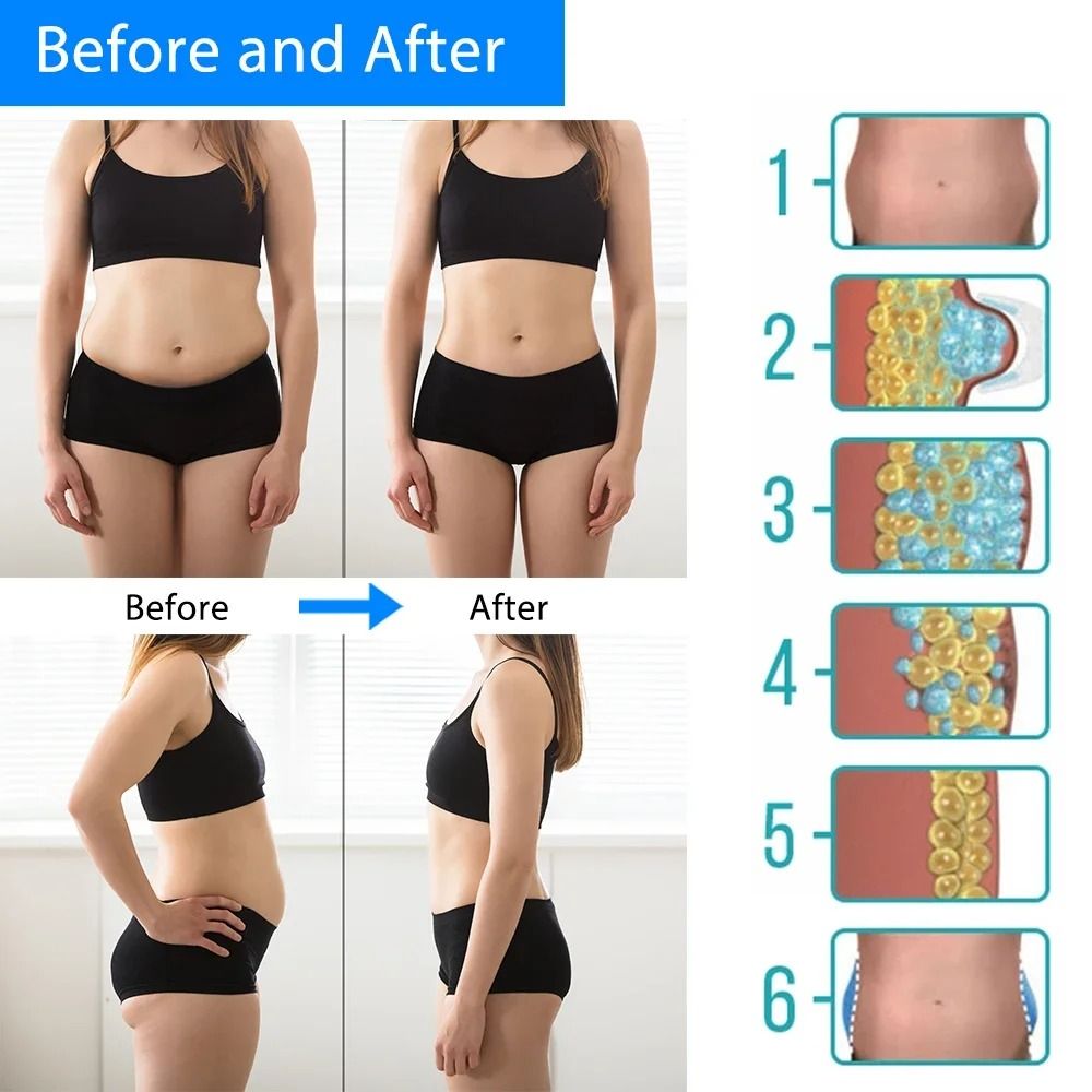 Cryotherapy Fat Freezing Machine Body Slimming and Cellulite Reduction Device