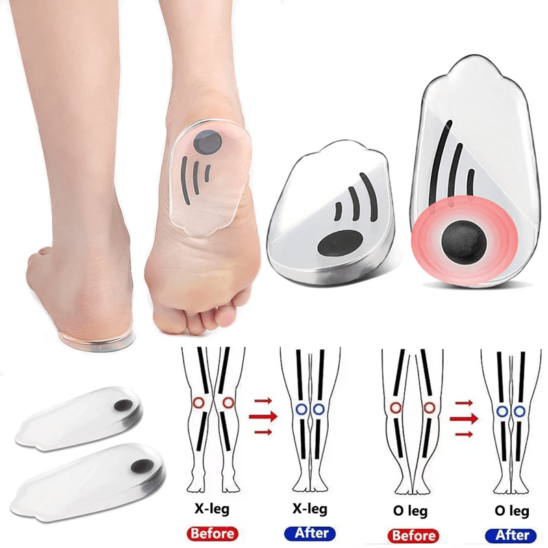 Magnetic Silicone Orthopedic Insoles – Plantar Fasciitis Relief & Foot Correction Heel Pads for O/X Legs