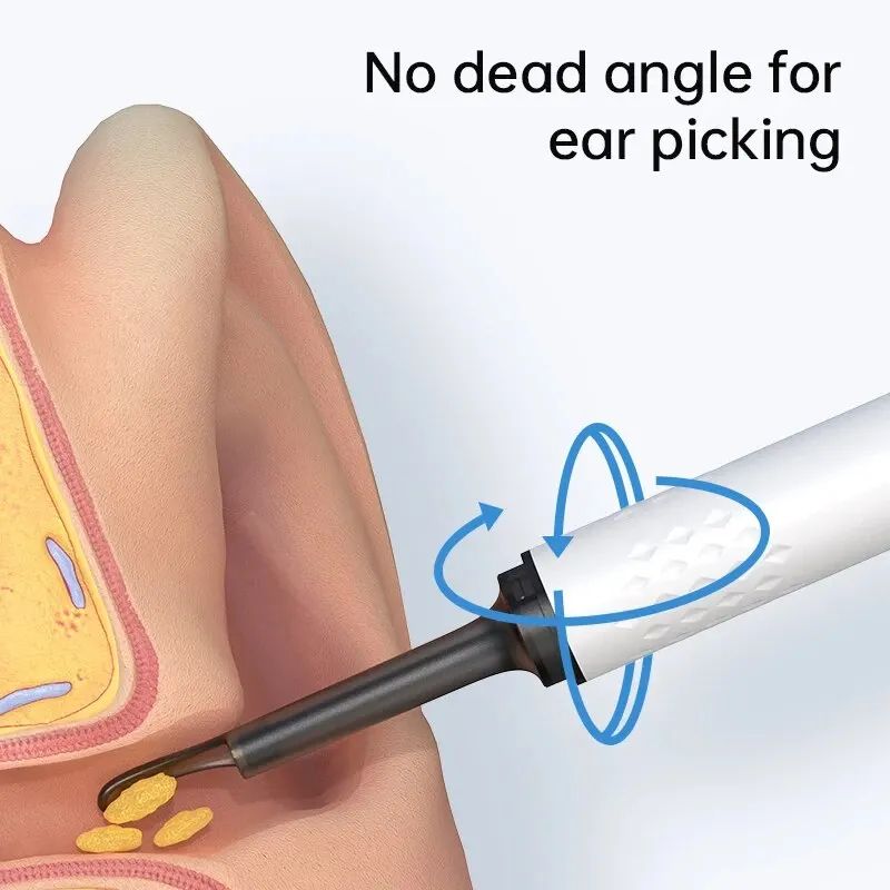 ClearView WiFi Ear Cleaner Camera – HD Otoscope Ear Wax Removal Tool with LED Lights