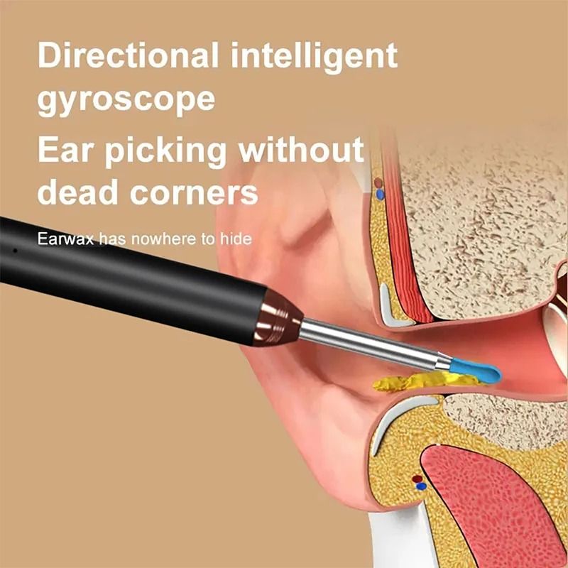 Smart Visual Ear Cleaner Otoscope with Camera USB C Charging Earpick Tool