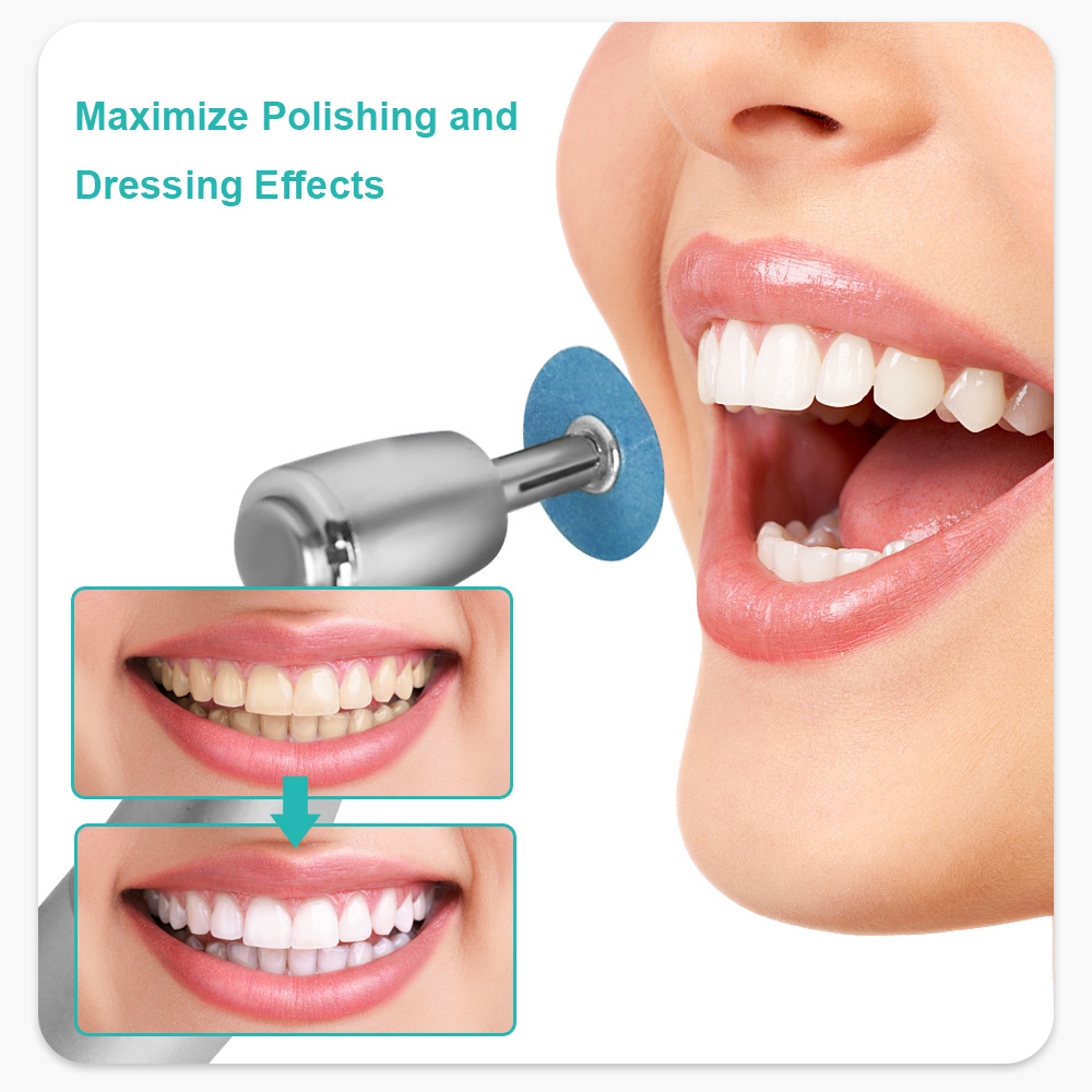 Dental Composite Polishing Discs, Gross Reduction & Contouring Mandrel Strips for Ceramics & Glass Ionomer Restorations
