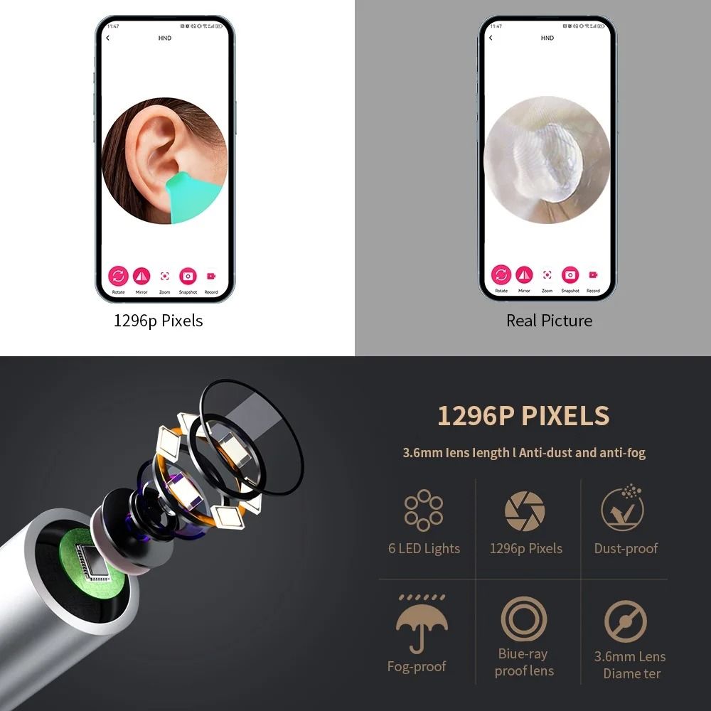 Smart Visual Ear Wax Removal Tool