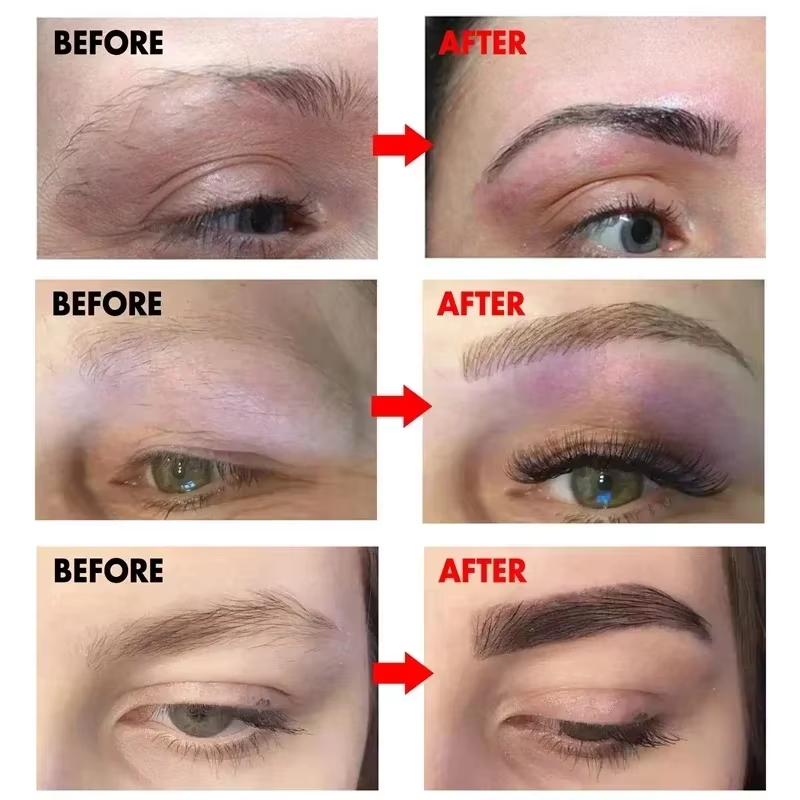 Eyebrow Growth Serum, Fast Eyelash Hair Growth, Anti Hair Loss Solution, Prevent Baldness, Fuller Thicker Eyebrows