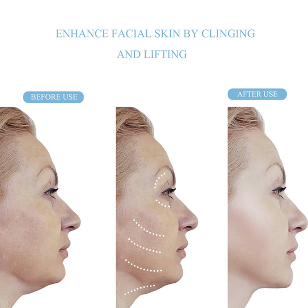 V Shape Lifting Tape To Revitalize Youthful Look