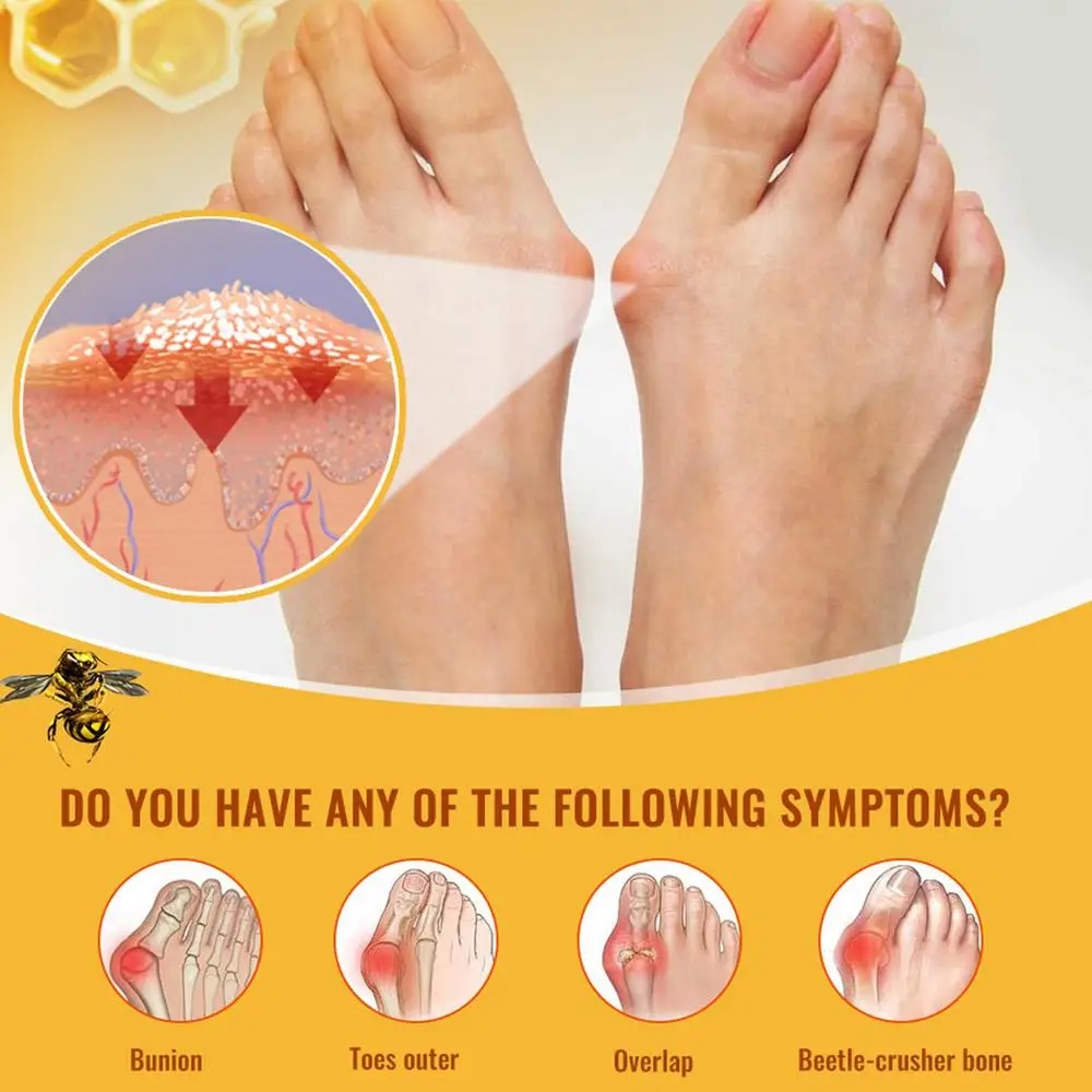 Bee Venom Treatment Gel