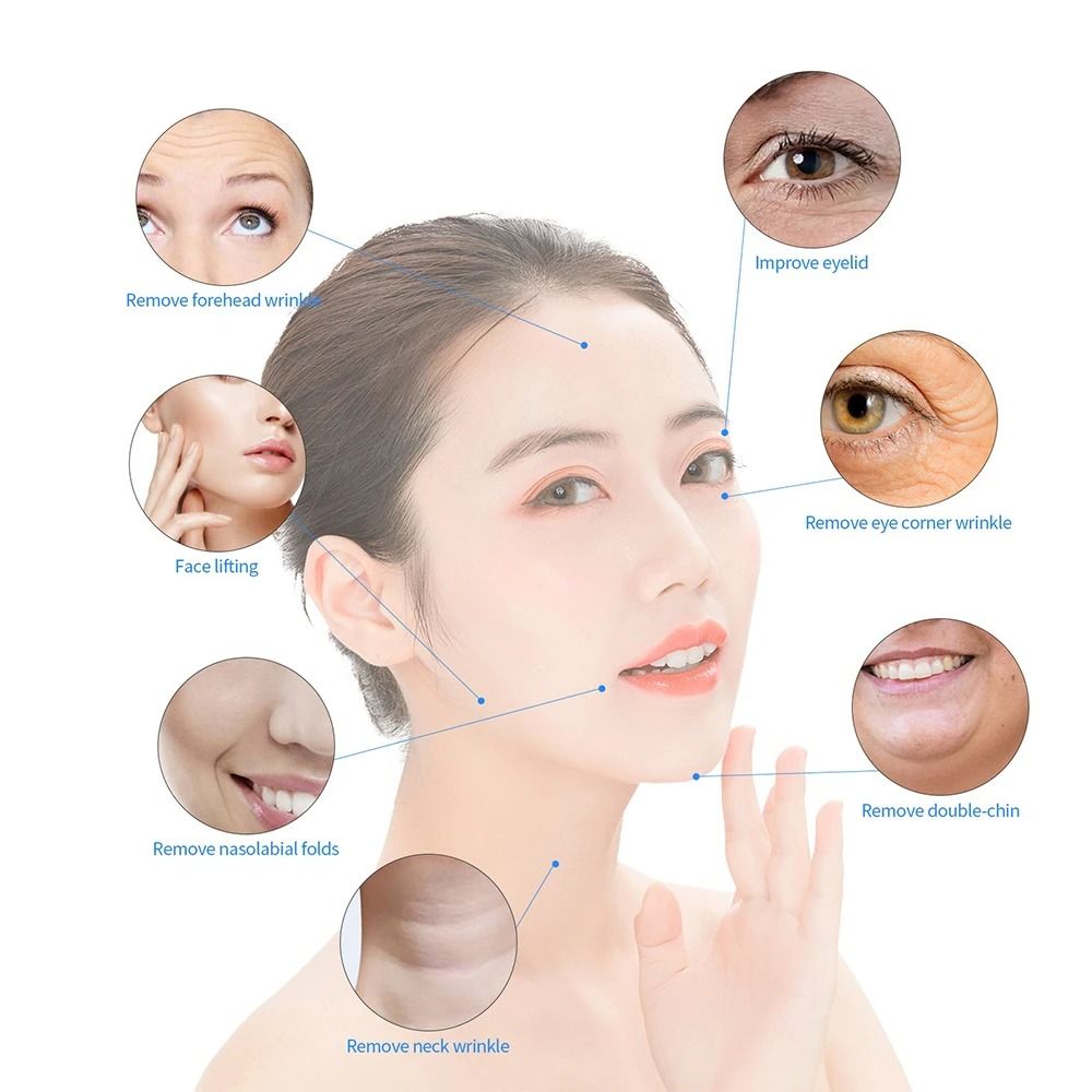 5MHz RF Tripolar Face Eye Body Skin Rejuvenation Lifting Wrinkle Removal Device