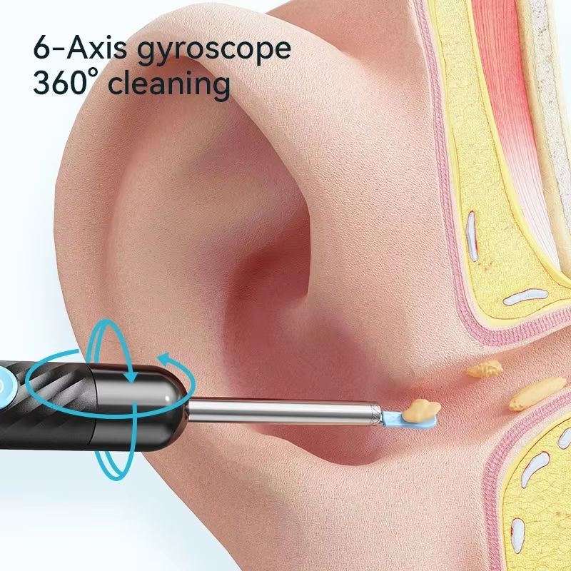 Wireless Ear Cleaner with 8MP Camera – Rechargeable Ear Wax Removal Kit with Ear Spoon