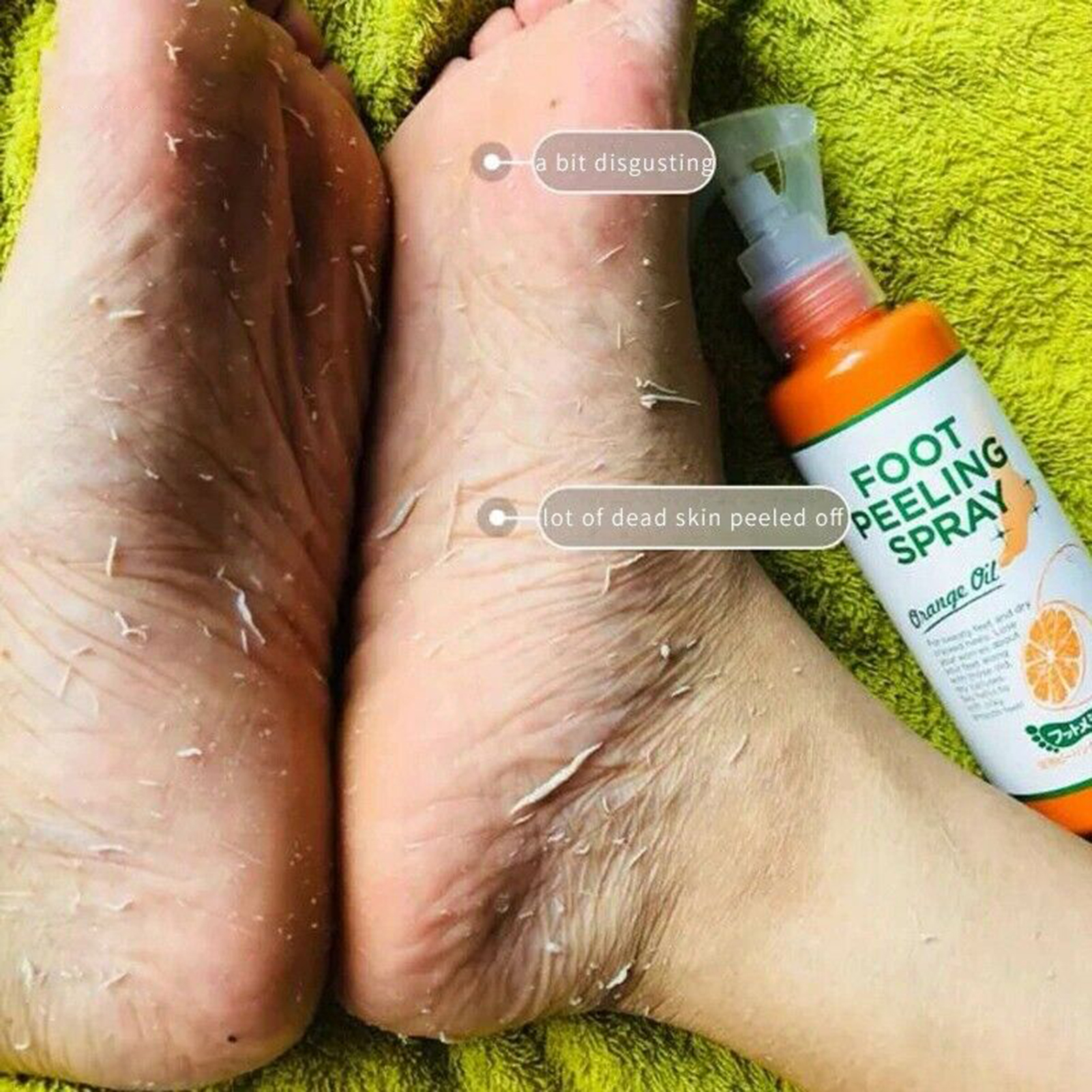 Foot Peeling Mask Callus Remover Exfoliating Foot Treatment for Smooth Soft Feet