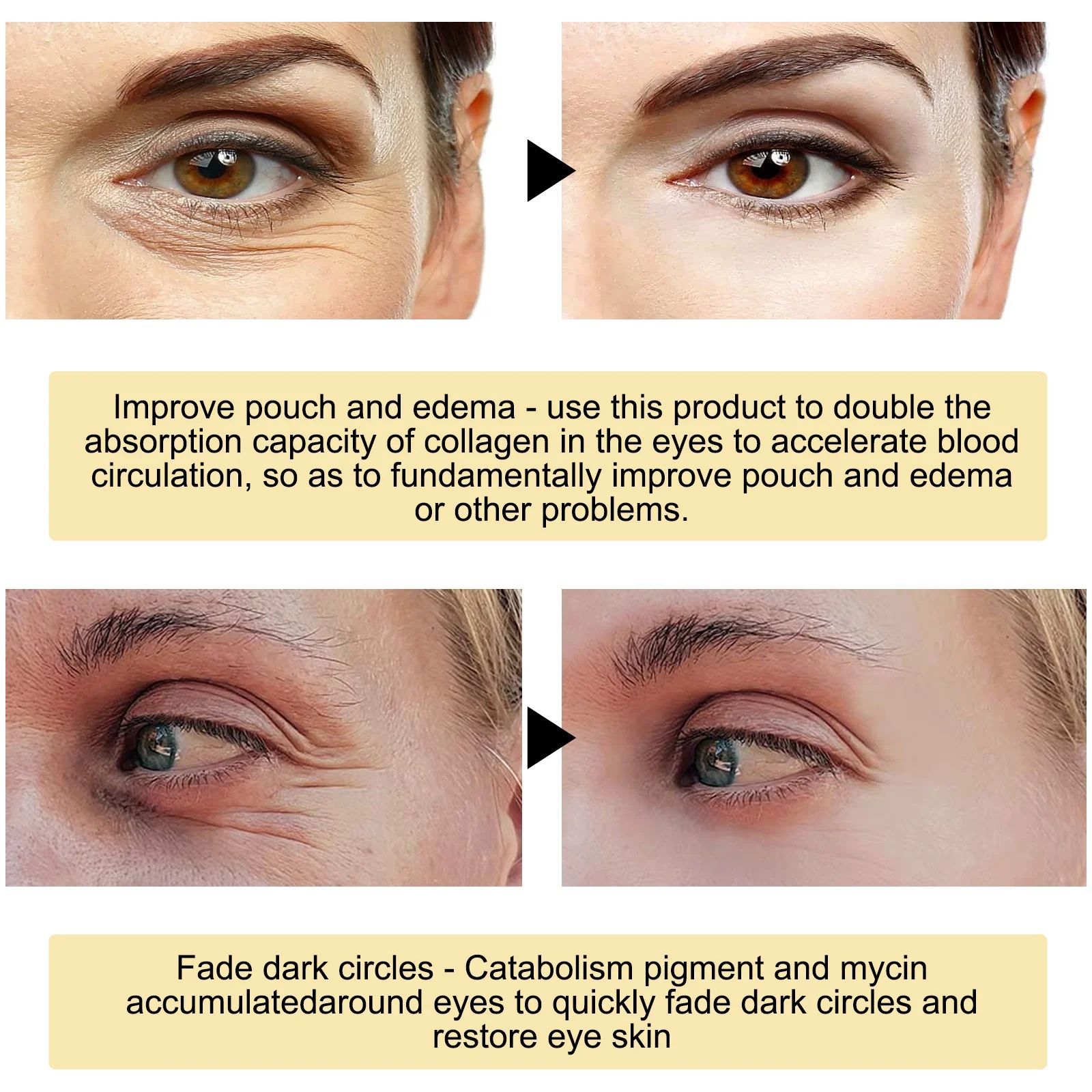 24K Gold Eye Radiance Hydrating Firming Eye Patches – 60pcs Anti-Dark Circles Under Eye Skincare Treatment